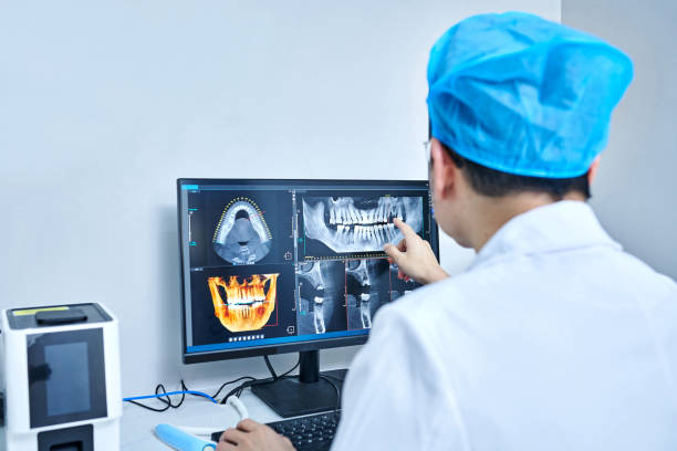 Best Emergency Treatment for Dental Infections or Abscesses in Baton Rouge, LA